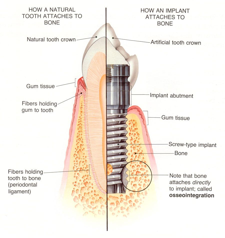 dental tools